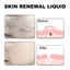 Skin Renewal Liquid, Reduce Acne Print Repair Acne Muscle Mild Clear Acne Hydrating Essence - Korvel