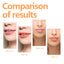 Changing Lip Oil, Mildly Removes The Lips Cutin Plentiful Full Fine Light Zerun Lip Oil - Korvel