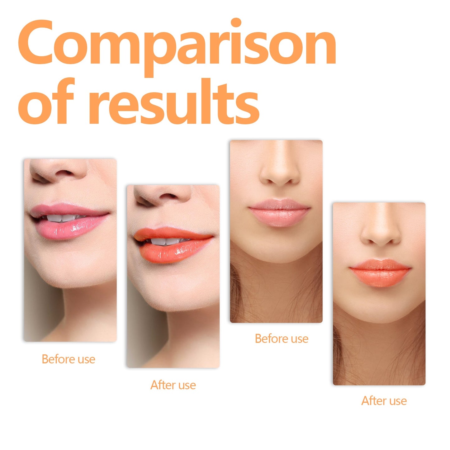 Changing Lip Oil, Mildly Removes The Lips Cutin Plentiful Full Fine Light Zerun Lip Oil - Korvel