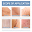 Oceaura Scar Repair Gel for Smooth and Moisturized Skin