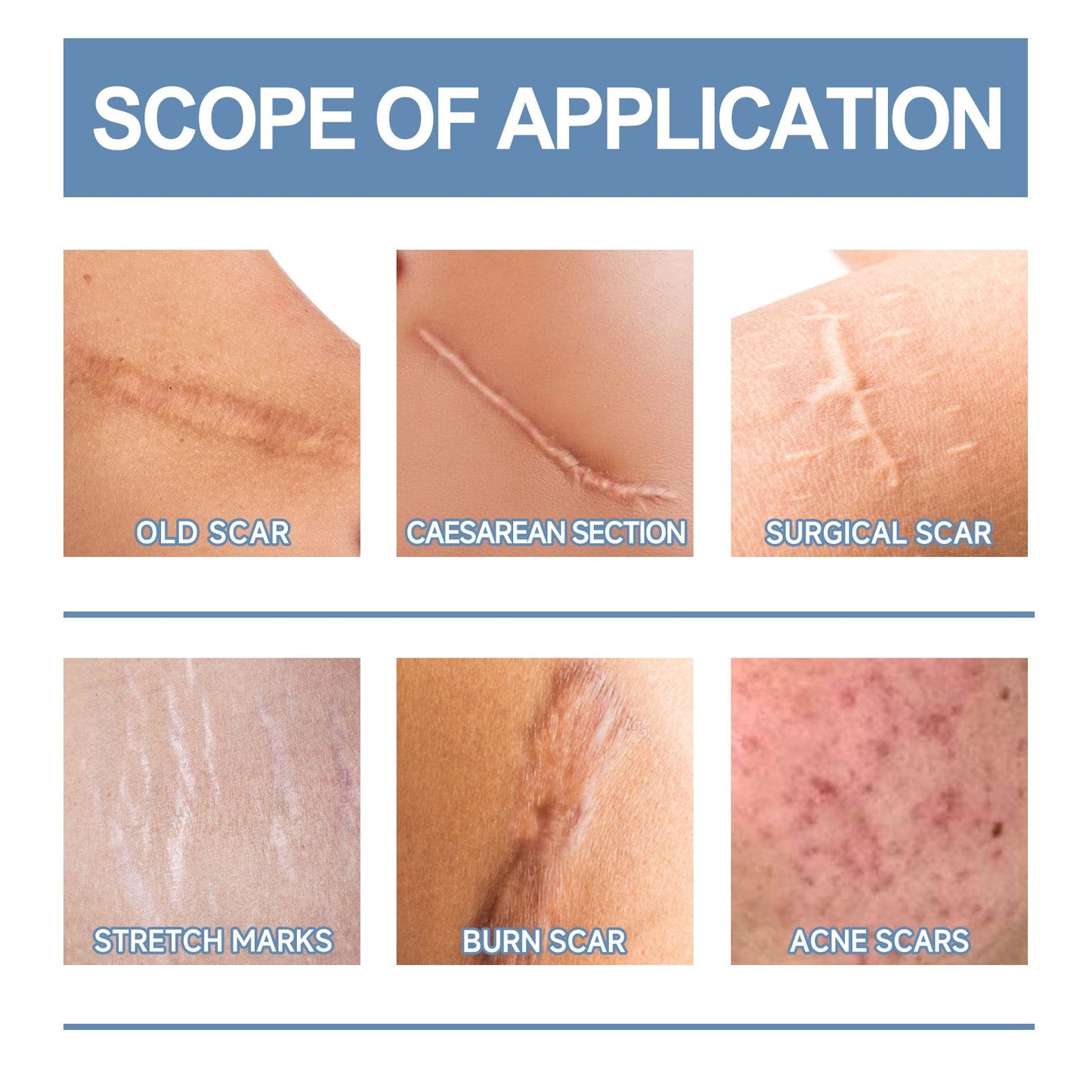 Oceaura Scar Repair Gel for Smooth and Moisturized Skin