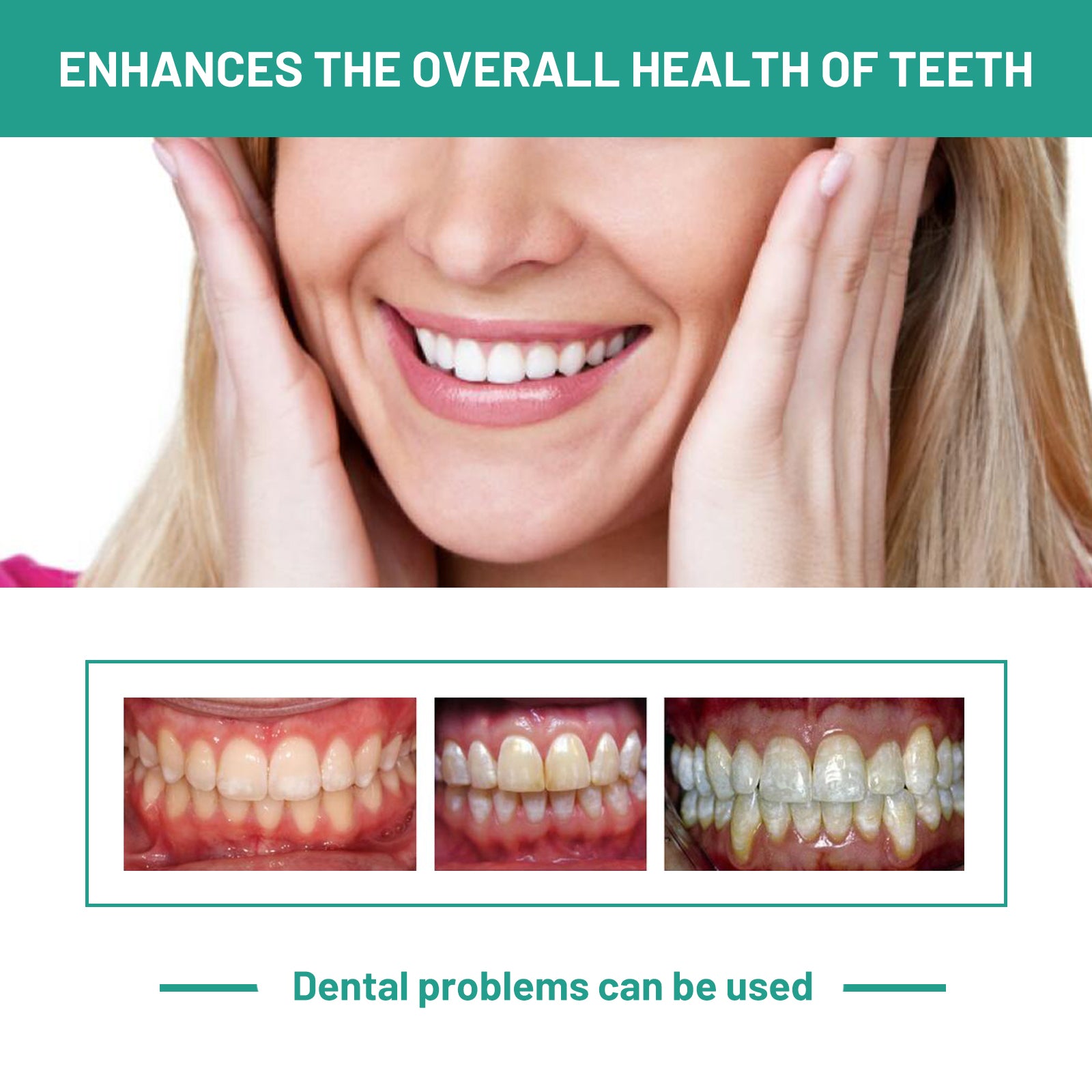 Probiotics Bright Whitening Teeth Mousse, Clean Mouth Odor Tartar Very Well To Protect The Gum Beautiful White Teeth - Korvel