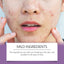 Multicolor Invisible Acne Patch for Clear Skin
