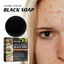 Gentle Cleansing Bar Soap for Face and Body