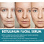 B5 Face Capsule Essence Reduces Fine Lines, Lifts Sagging, Firming And Moisturizing Face - Korvel
