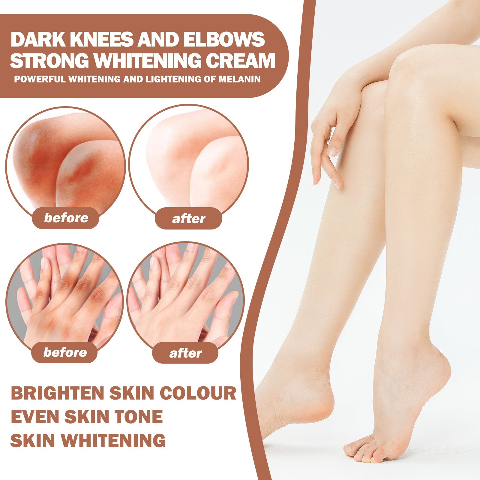 Joint Whitening Cream, Moisturizes Dull Skin Whitening Repair Cream For Joints And Elbows - Korvel