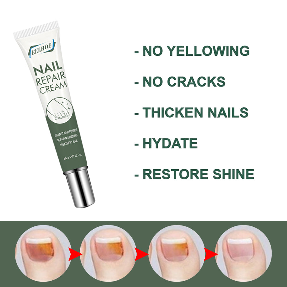 Crema Reparadora de Uñas Premium para el Cuidado de los Pies