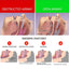 Anti-Snoring Braces Anti-Snoring, Anti-Grinding, Anti-Breathing Mouth Guard Anti-Snoring Dental Support Protective Braces - Korvel