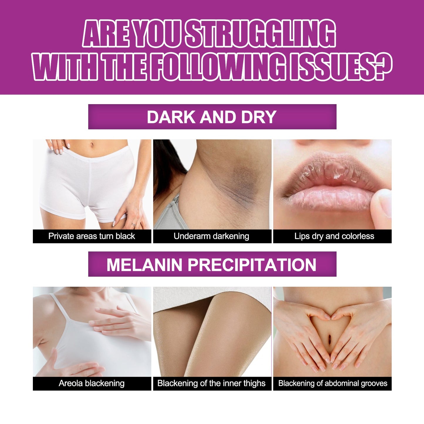 Skin Firming Cream, Brightening Skin Melanin Removal Brightening Skin Moisturizing Cream - Korvel