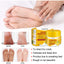 Cracked Skin Banana Repair Cream, Nourishing And Moisturizing Foot Repair Cream To Soften Exfoliation And Remove Dead Skin Calluses - Korvel