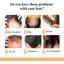 Rice Anti-Slip Shampoo Soap, Moisturizes Scalp Cleans Hair Repairs Damaged Hair And Strengthens Hair Shampoo Soap - Korvel