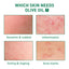 Tea Tree Oil Acne Serum, Remove Acne, Clear Acne, Repair Skin, Lighten Acne Printing Face Essence - Korvel