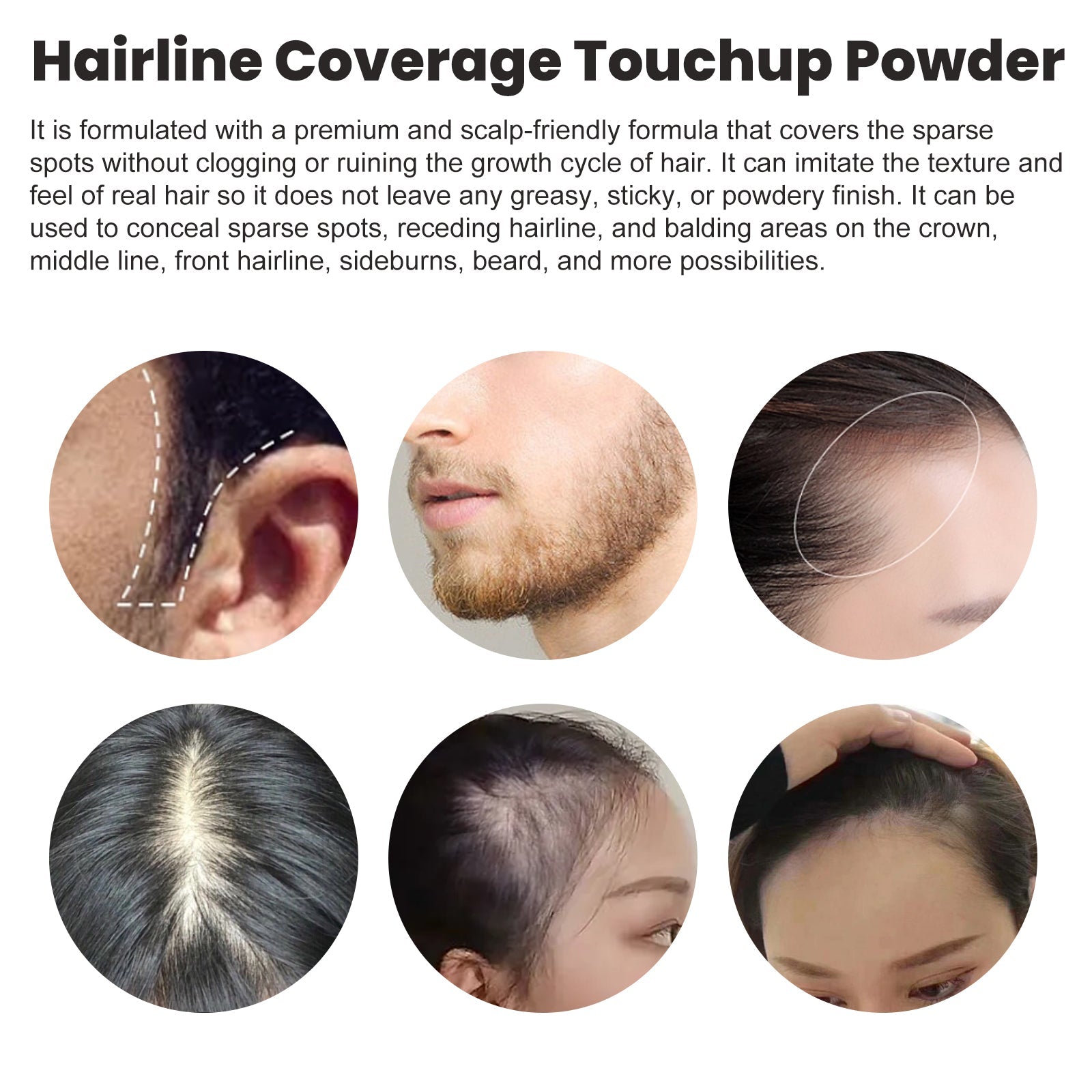 Hairline Cover Touch Powder Compact Hairline Easy To Apply Concealer Powder For Your Hairline - Korvel