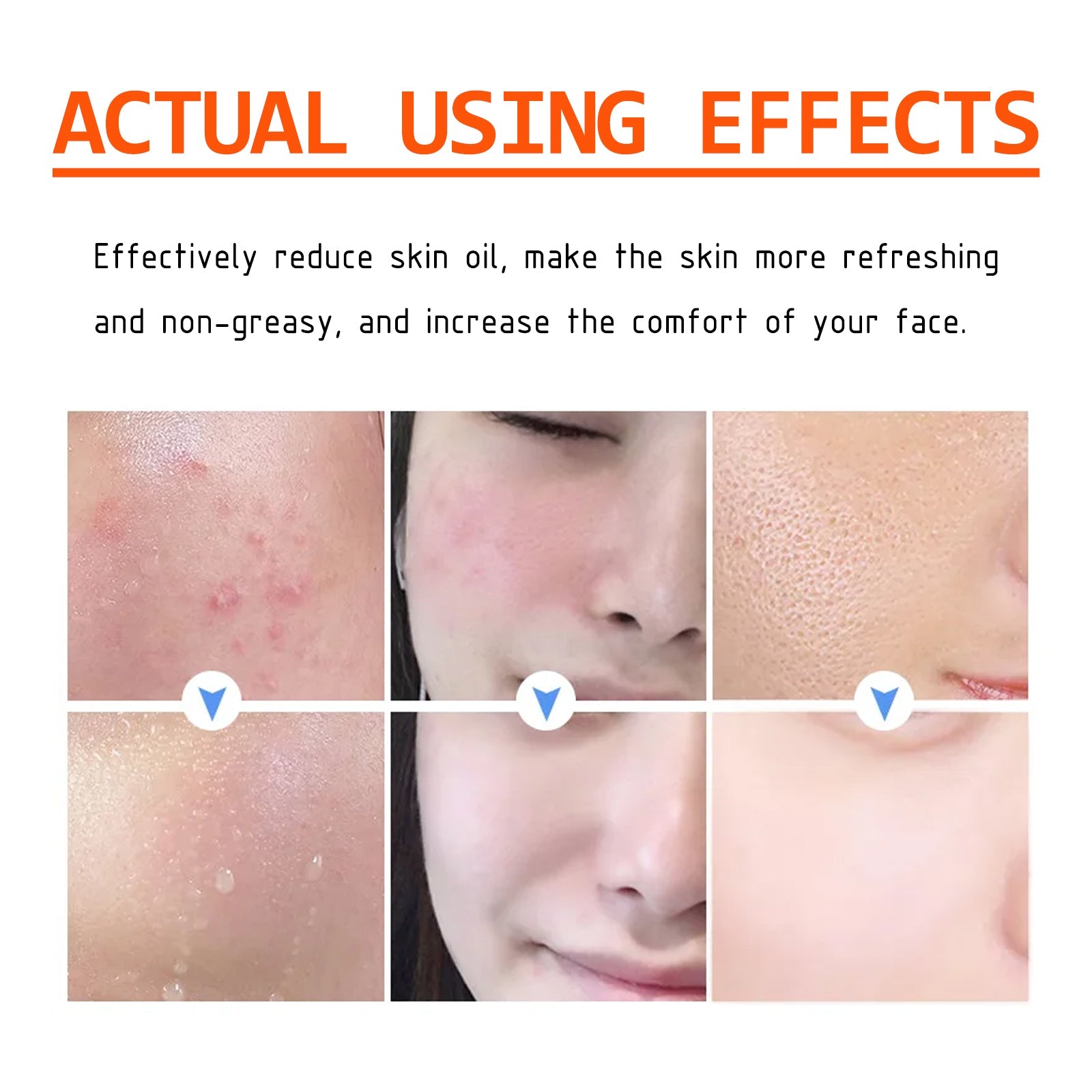 Salicylic Acid Facial Mask Gentle Cleansing Mask To Lighten Acne, Seal And Tighten Pores - Korvel