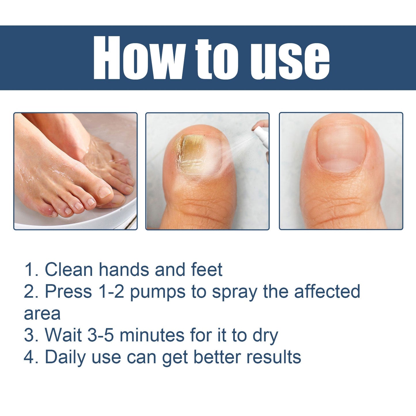 Moisturizing Nail Care Spray for Brightening Foot Nails