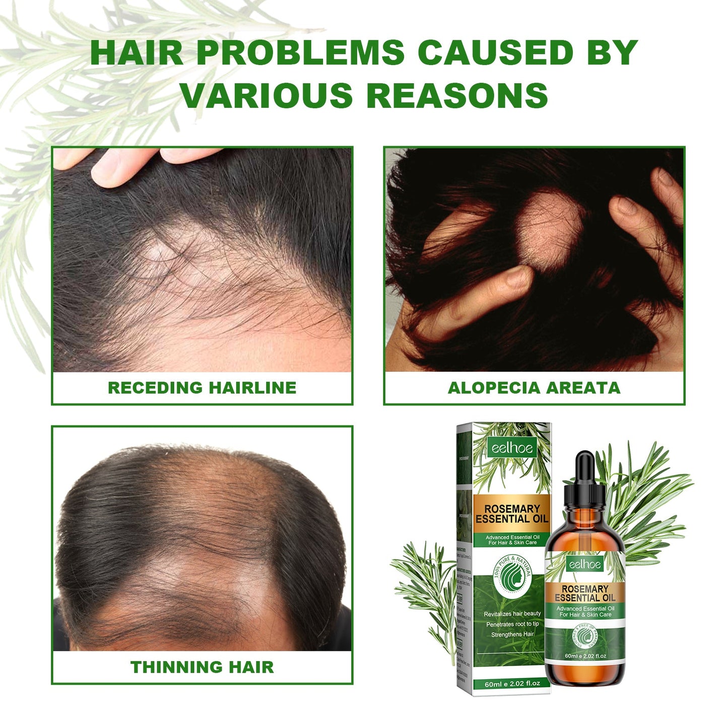 Rosemary Essential Oil Hydrates And Moisturizes Damaged Hair, Strengthens Hair And Softens Hair Care Essential Oil - Korvel