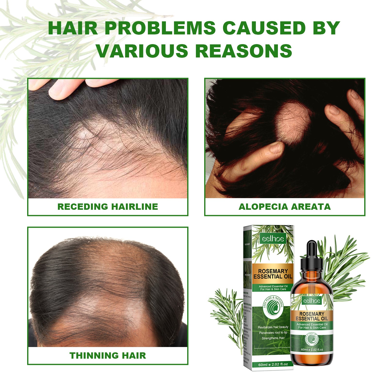 Rosemary Essential Oil Hydrates And Moisturizes Damaged Hair, Strengthens Hair And Softens Hair Care Essential Oil - Korvel