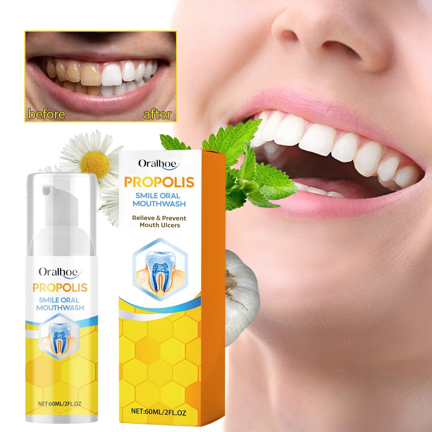 Propolis Oral Cleaning Mousse Oral Cleaning Care Tooth Stain Removal Fresh Mousse Toothpaste - Korvel