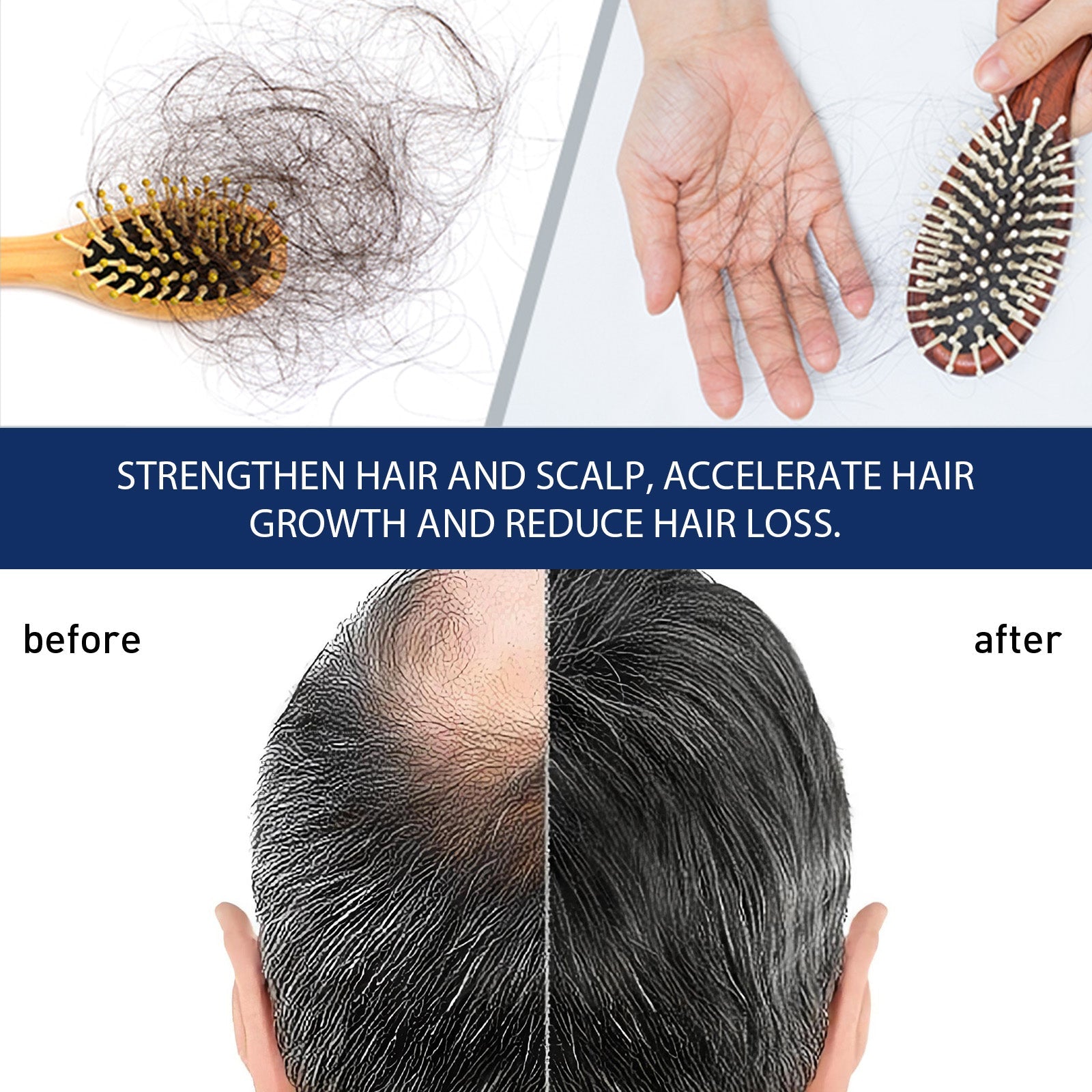 Alopecias Hair Growth Cream, Protect Hair Follicles Strong Moisturizing Thick Hairline Hair - Korvel