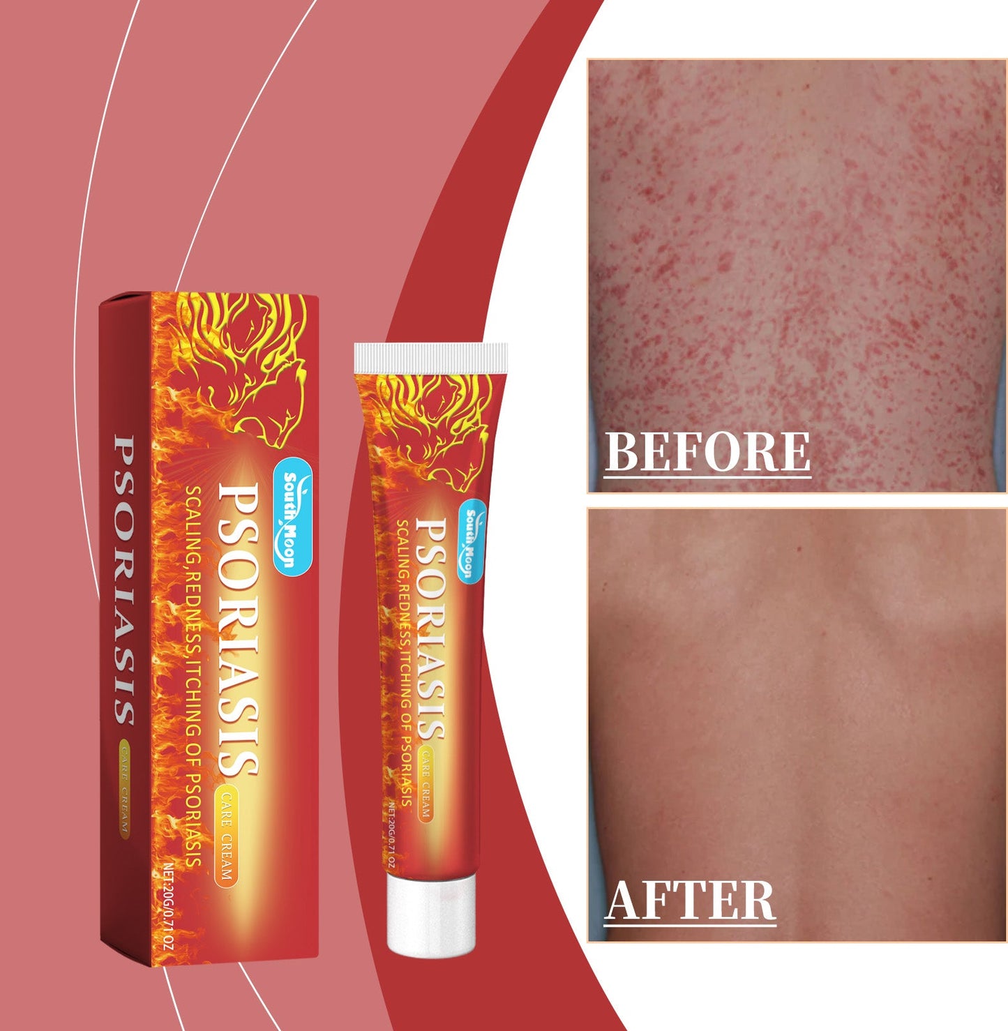 Skin Care Cream, A Gentle Formula To Moisturize Dry Skin - Korvel