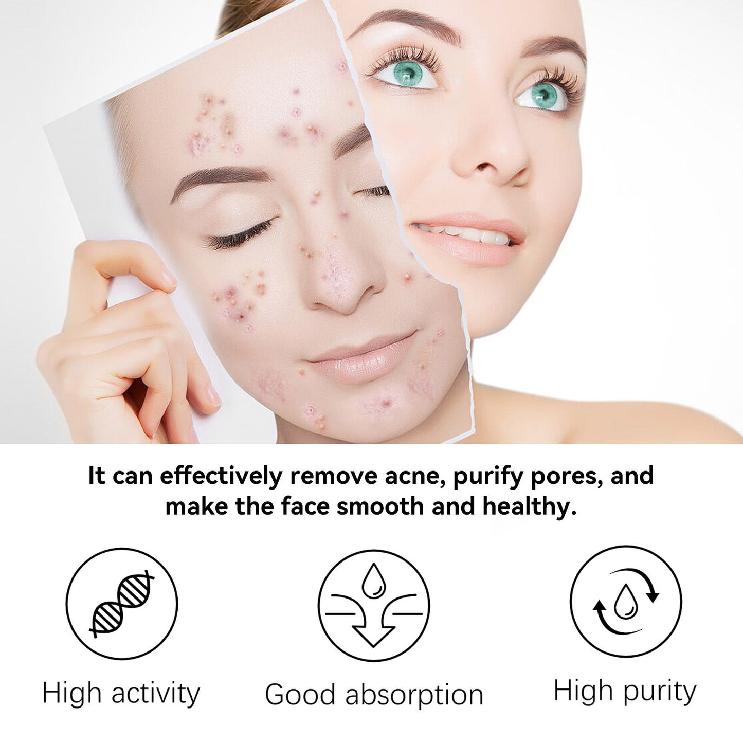 Premium Herbal Acne Serum for Clear Skin