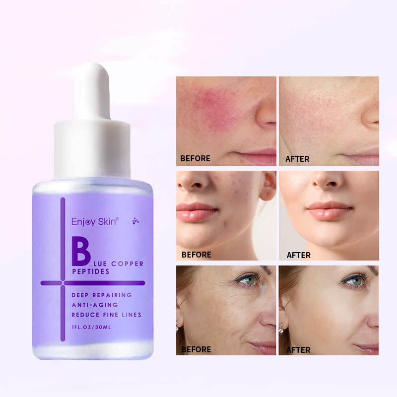 Enjoy Skin Organic Vegan Facial Skin Care Serum Whitening Anti Aging Copper Peptide Face Serum 30ml - Korvel