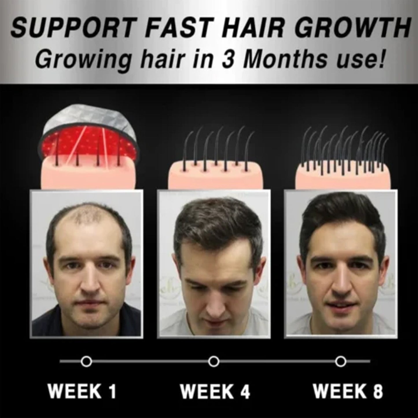 Premium Hair Growth Treatment Heating Massage Cap