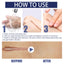 Scar Gel, Fade Skin Scar Pregnancy Surgery Scar Moisturizing Skin Care Gel - Korvel