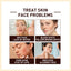Rice Anti Wrinkle Essence, Repairs Skin Moisturizes Firms Whitens Essence - Korvel