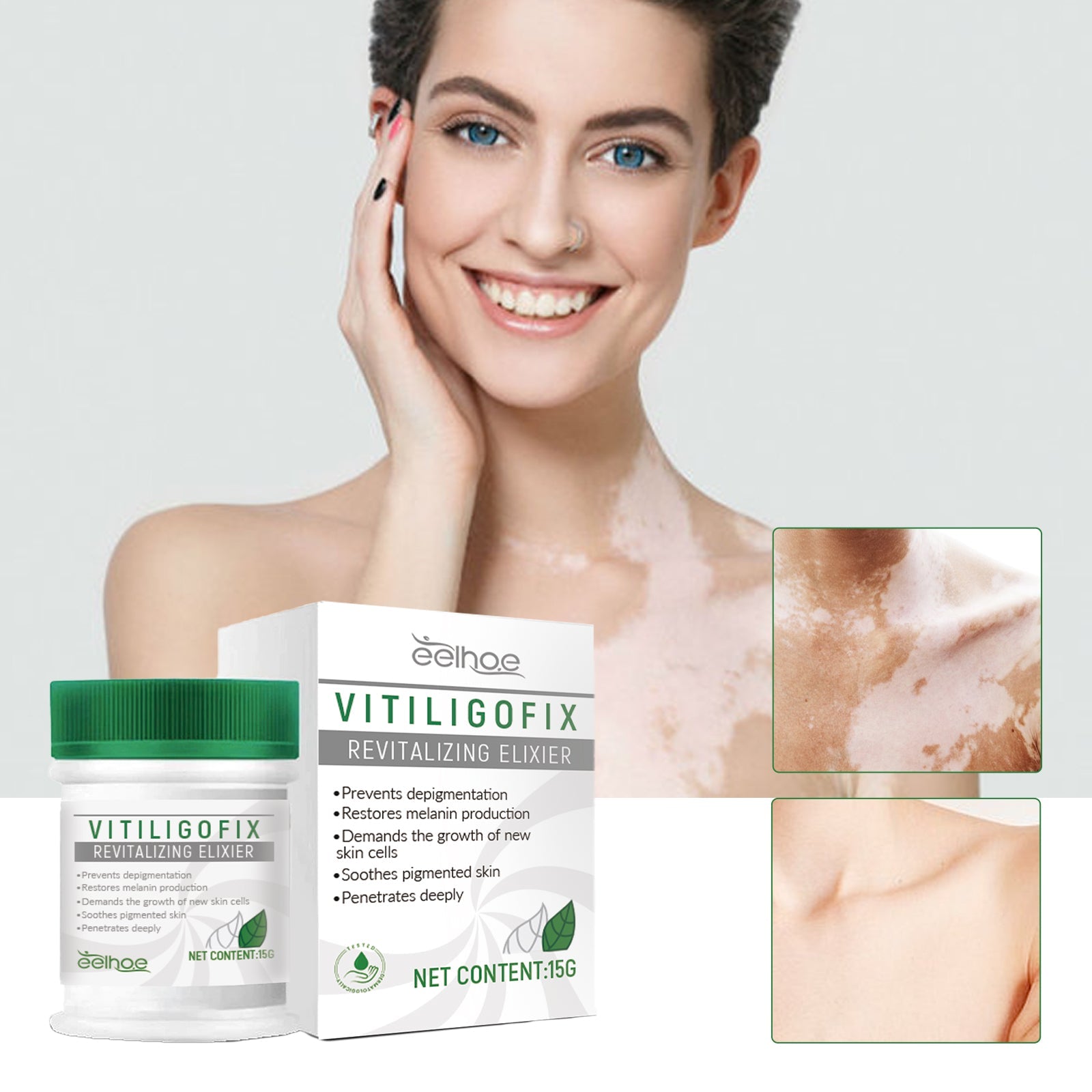 White Spot Repair Cream Skin White Spot Melanin Repair Even Skin Tone Topical Care Cream - Korvel