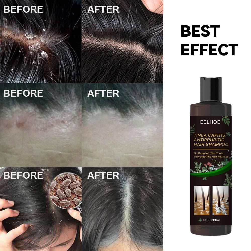 Shampoo anti-pelliculaire rafraîchissant pour des soins capillaires sains