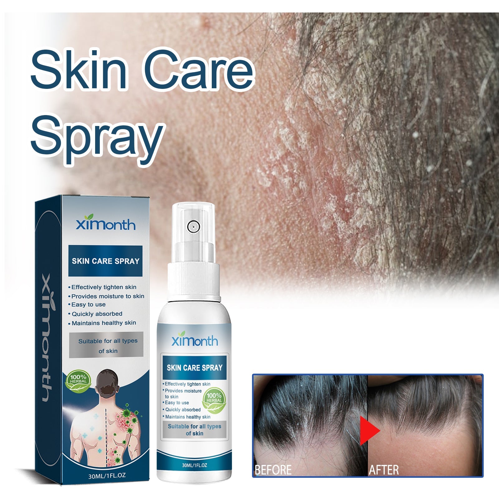 Cowhide Moss Repair Spray Relieves Redness And Itchy Scalp Skin Repair Spray - Korvel