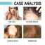 Multi-Peptide Serum For Hair Density, Fall Prevention Dense Hair Repair Damaged Hair Supple Hair Moist Hair Hair Oil - Korvel