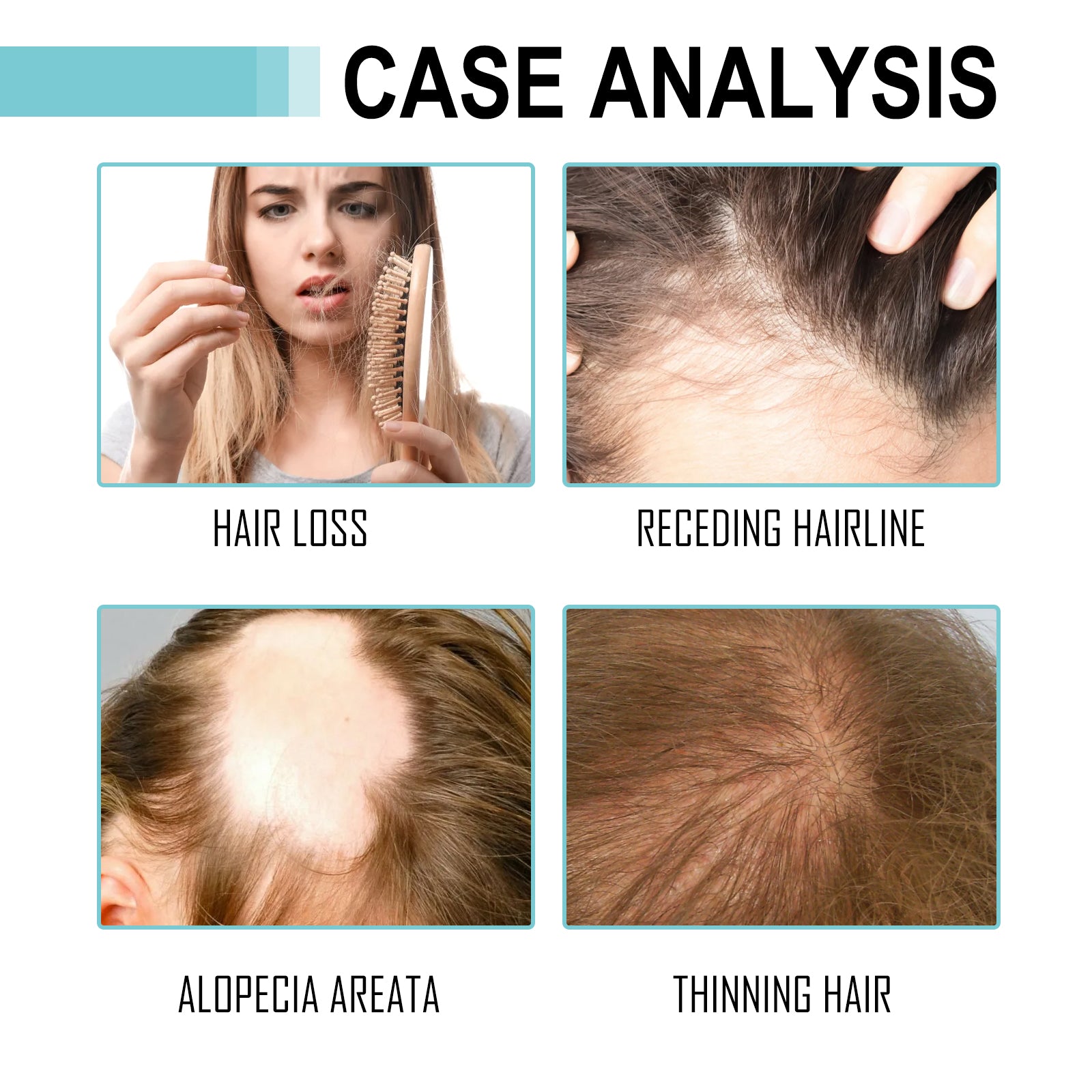 Multi-Peptide Serum For Hair Density, Fall Prevention Dense Hair Repair Damaged Hair Supple Hair Moist Hair Hair Oil - Korvel