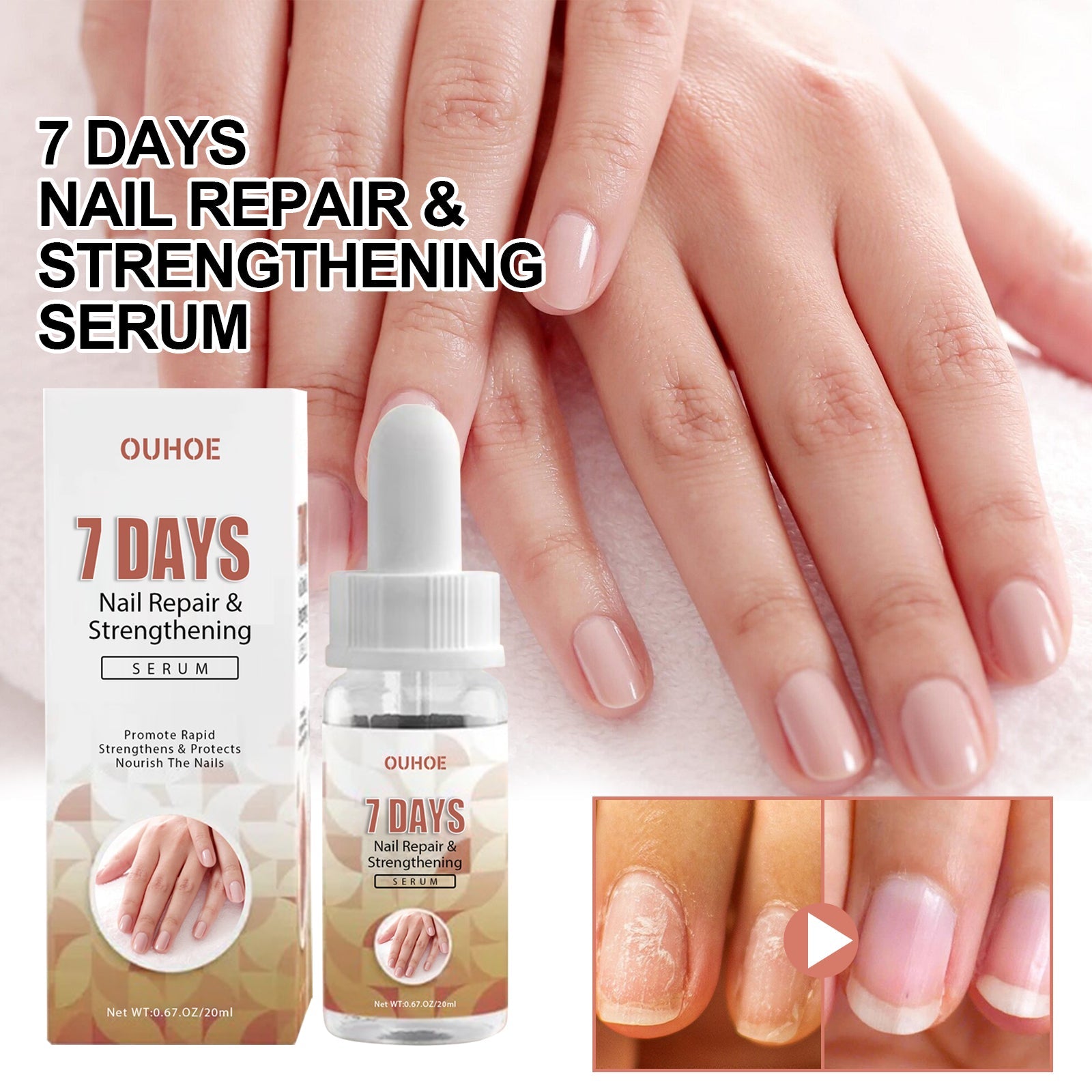 7 Day Nail Repair Essence, Hand And Foot Gray Nail Brightening Soft Nail Thickening Toenail Care Solution - Korvel