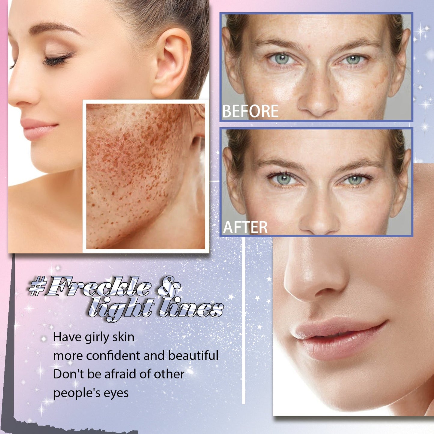 Freckle Removing Anti-aging Essence, Facial Firming Anti-wrinkle Lightening Melasma Stain Nourishing Skin Essence - Korvel