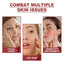 Collagen Membrane, Lighten Wrinkles, Bags, Dark Circles, Firm Skin, Plump And Moisturize Eye Rejuvenation Mask - Korvel