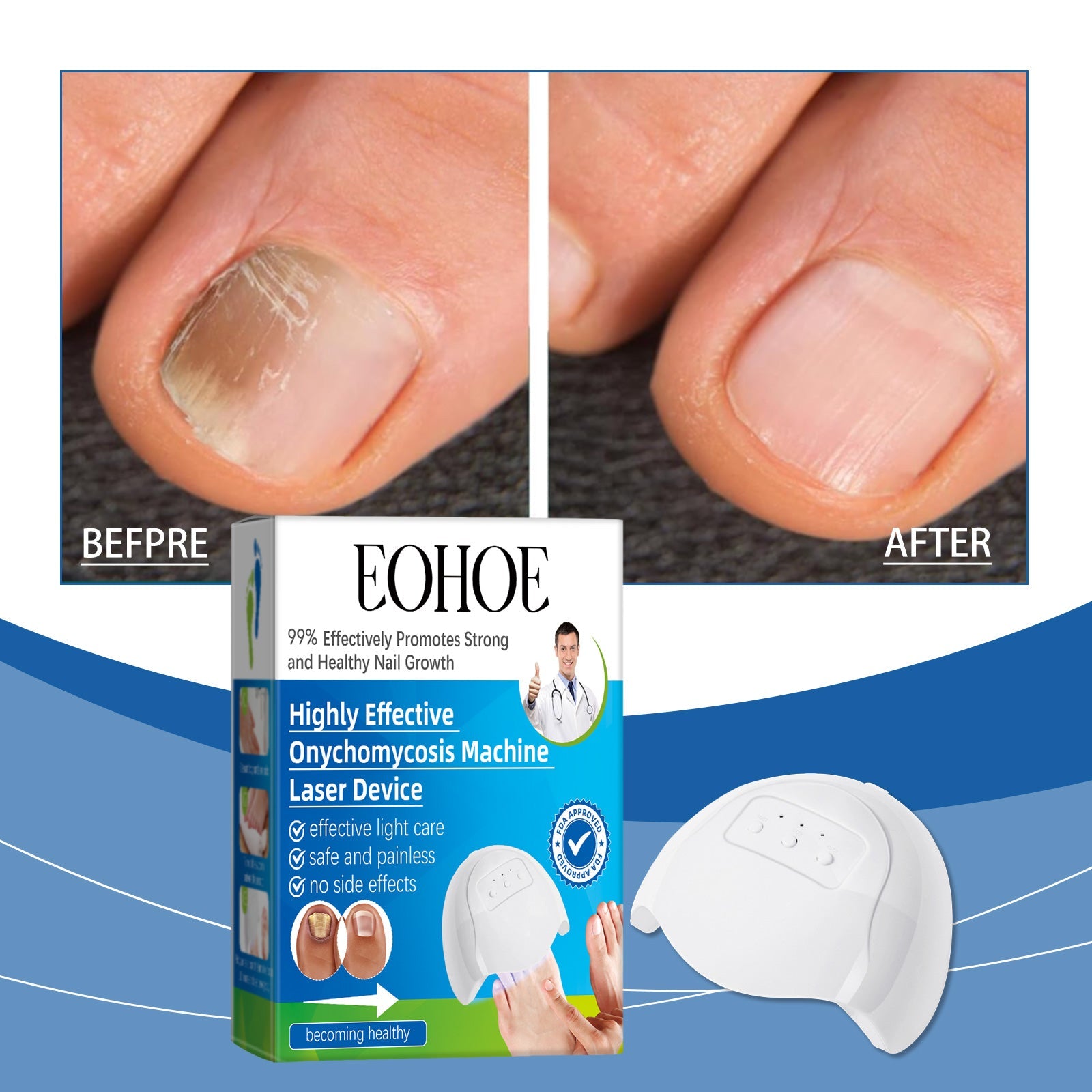 Eohoe Nail Care Instrument, Gentle Clean Nails Repair Hand, Foot And Finger Edge Rotten Nail Care Instrument - Korvel