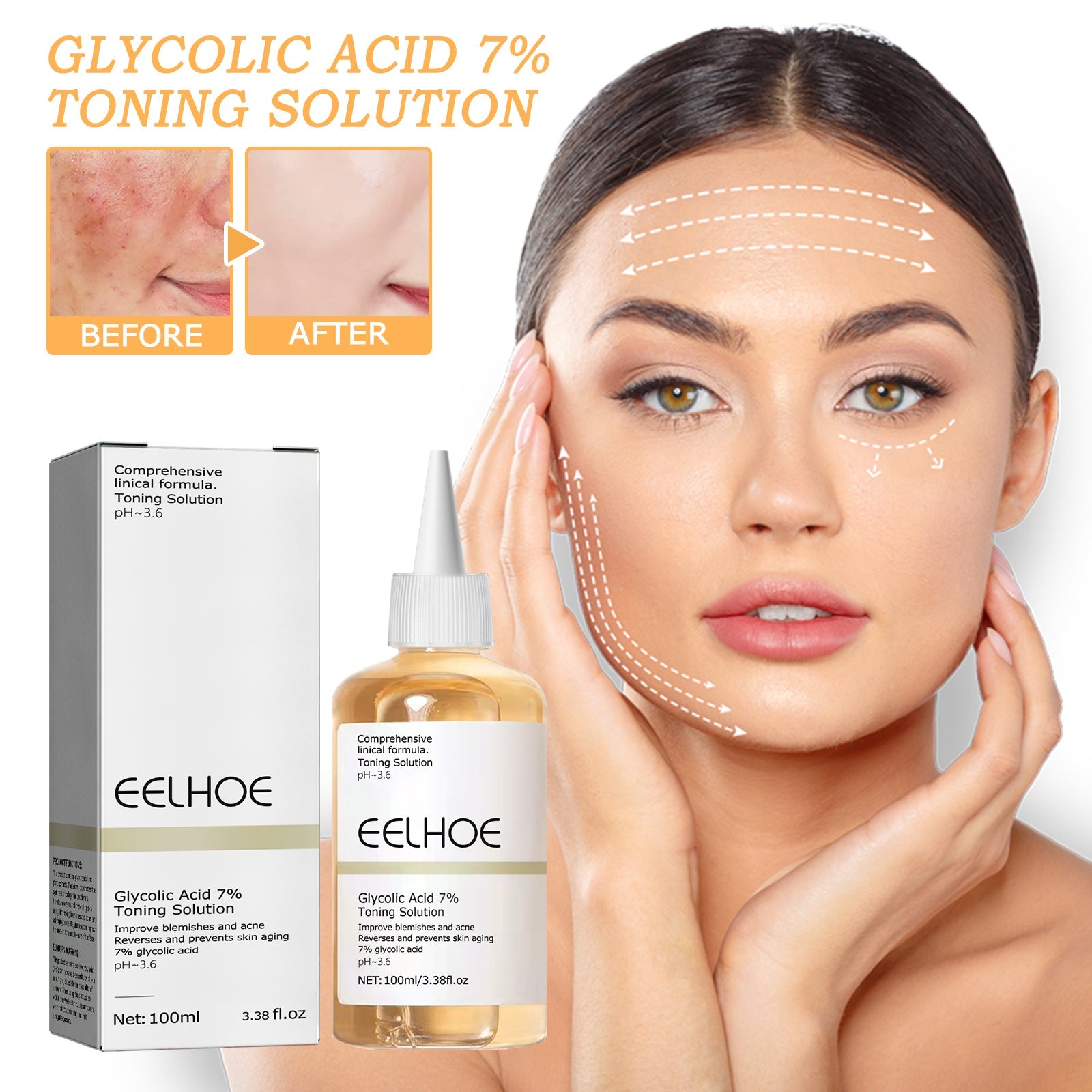 Glycolic Acid 7% Toner, Remove Acne Lighten Acne Repair Acne Mark Moisturize Skin Toner - Korvel