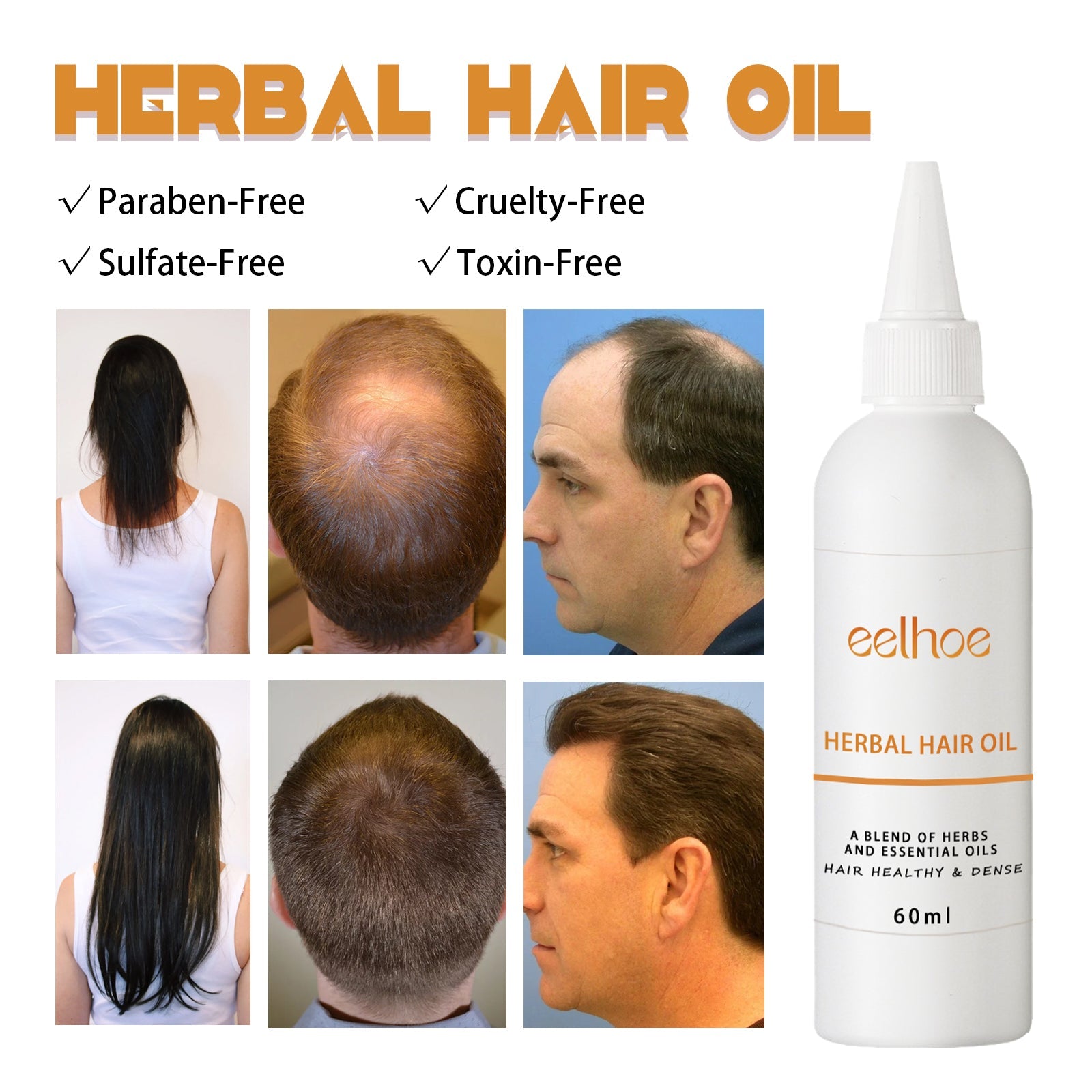 Herb Thickening Hair Oil, Repairing Dry Hair, Moisturizing And Smoothing Hair And Hair Conditioning Oil - Korvel