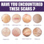 Silicone Scar Patch, Reduces Stretch Marks And Hyperplasia Of Caesarean Section Scars Silicone Patch - Korvel