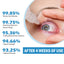 Eye Drops Dryness Soothing, Relieve Eye Fatigue, Dry Eyes, Red Eyes, Blurred Vision Eyes Care Lotion - Korvel