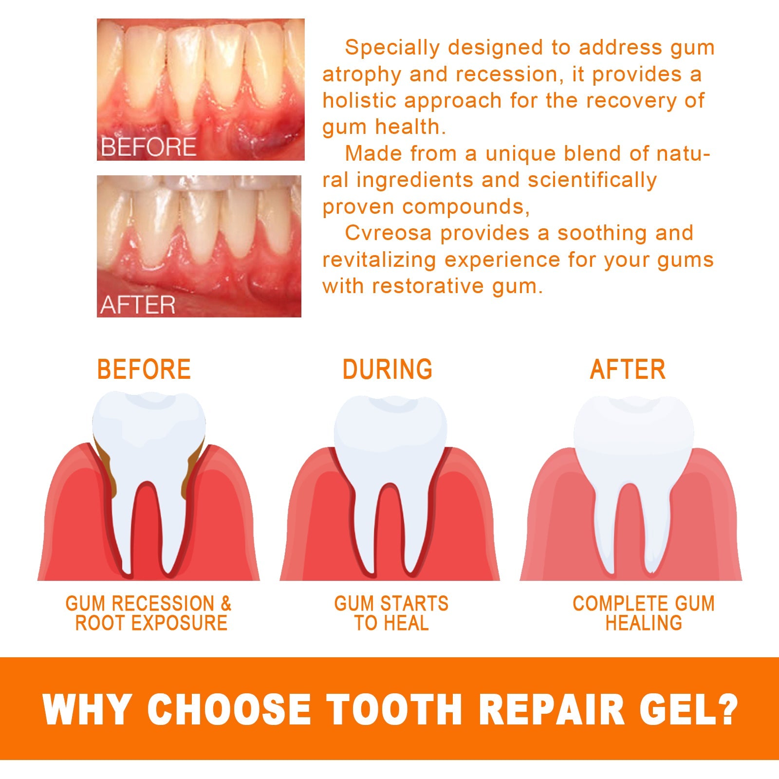 Tooth Repair Essence, Cleaning Teeth Stains Tartar Care Gums Oral Care Essence - Korvel