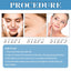 Niacinamide Serum, Lightening And Whitening Skin Moisturizing And Anti-Wrinkle Essence - Korvel