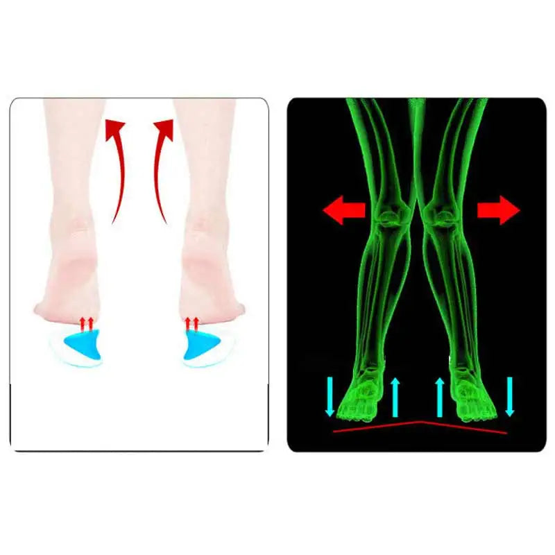 Premium Arch Support Insoles for Enhanced Comfort