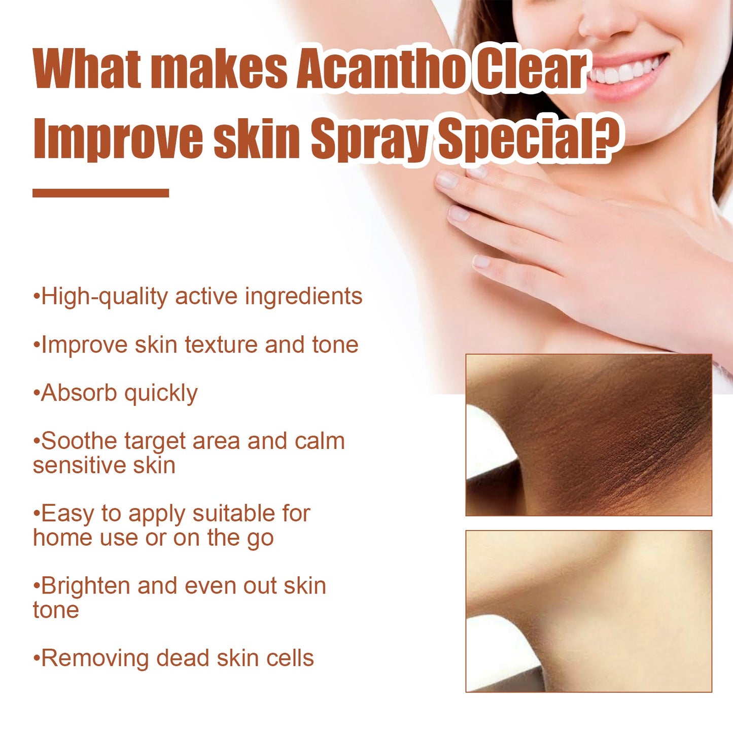 Acantho Clear Improve Skin Spray, Repair Black Spot, Elbow Knee Joint Black Whitening Skin Spray - Korvel