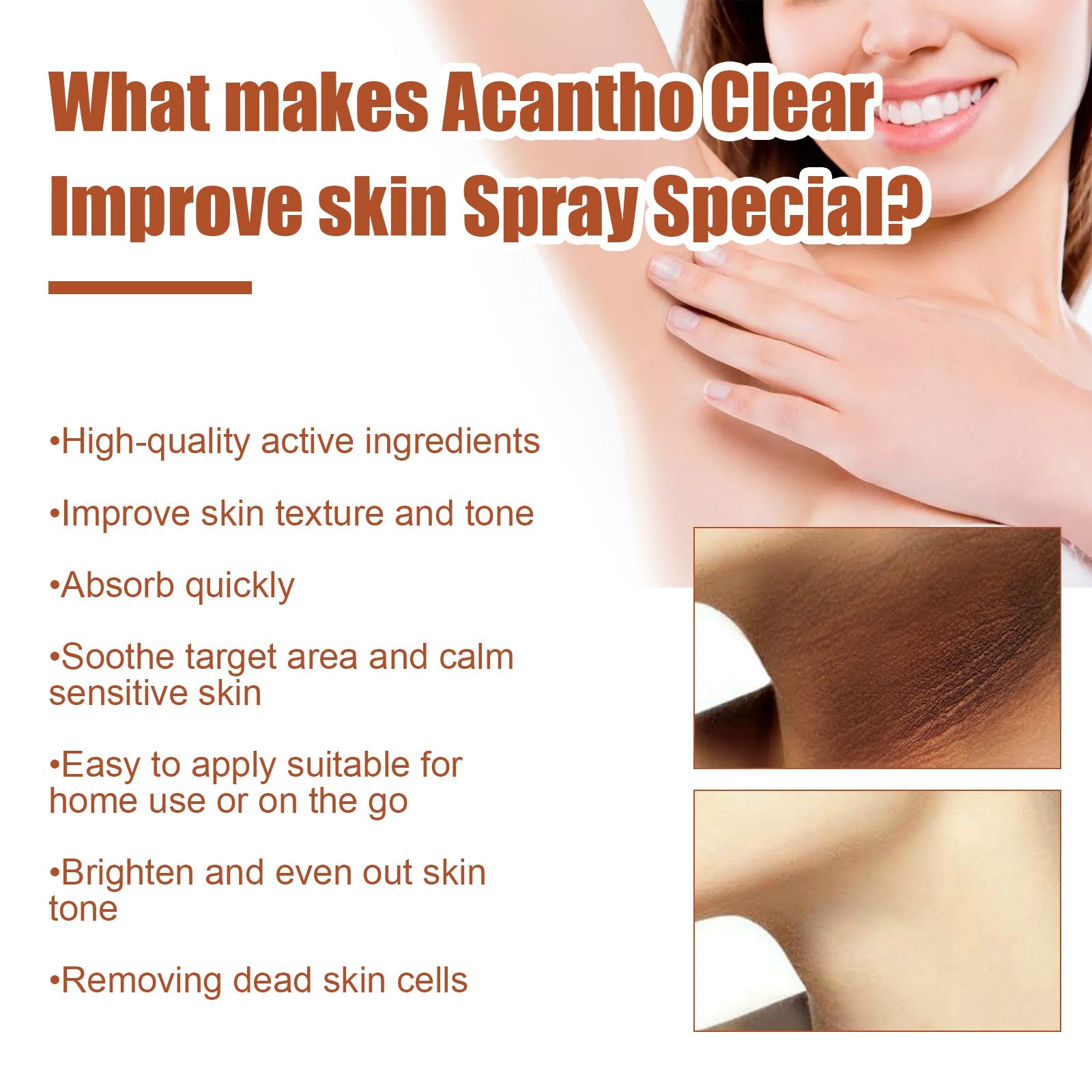 Acantho Clear Improve Skin Spray, Repair Black Spot, Elbow Knee Joint Black Whitening Skin Spray - Korvel