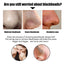 Black Pig Nose Patch, Bamboo Charcoal Remove Blackhead Acne Tear Nose Mask Patch - Korvel