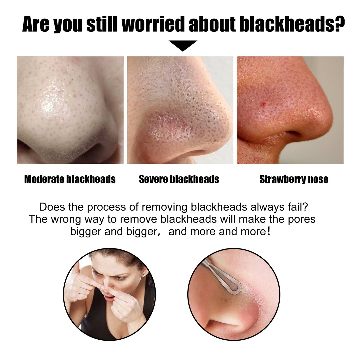 Black Pig Nose Patch, Bamboo Charcoal Remove Blackhead Acne Tear Nose Mask Patch - Korvel