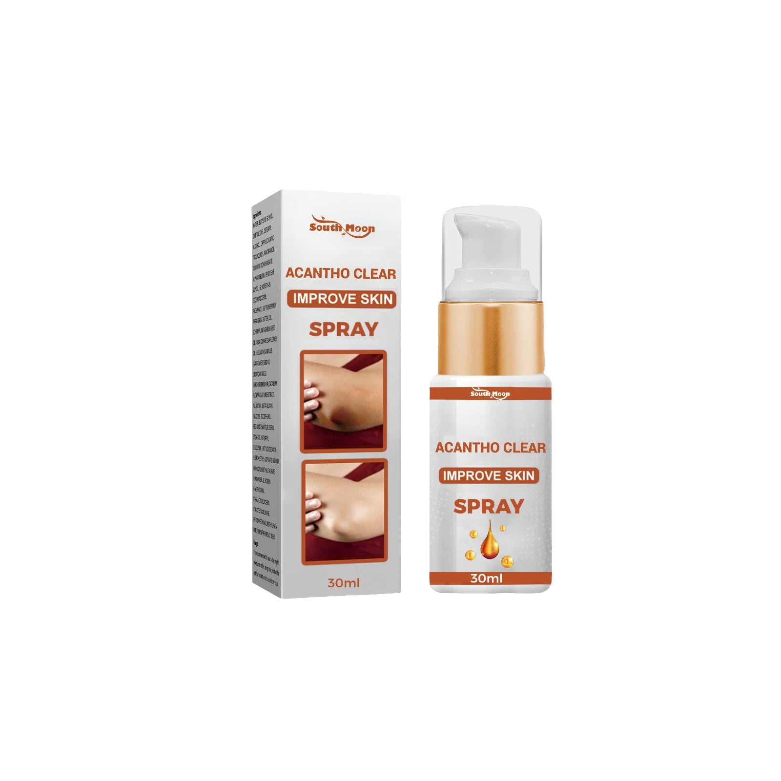 Acantho Clear Improve Skin Spray, Repair Black Spot, Elbow Knee Joint Black Whitening Skin Spray - Korvel
